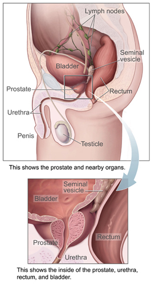 prostate2.jpg